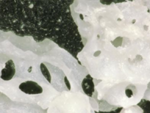Macro close-up of a mix of dense and porous white bone particulate granules against a dark background.