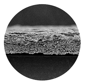 A black-and-white magnified cross-section image of a layered, porous membrane structure.