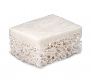 A rectangular block showing a smooth white cortical layer on top and a porous, sponge-like cancellous layer below.
