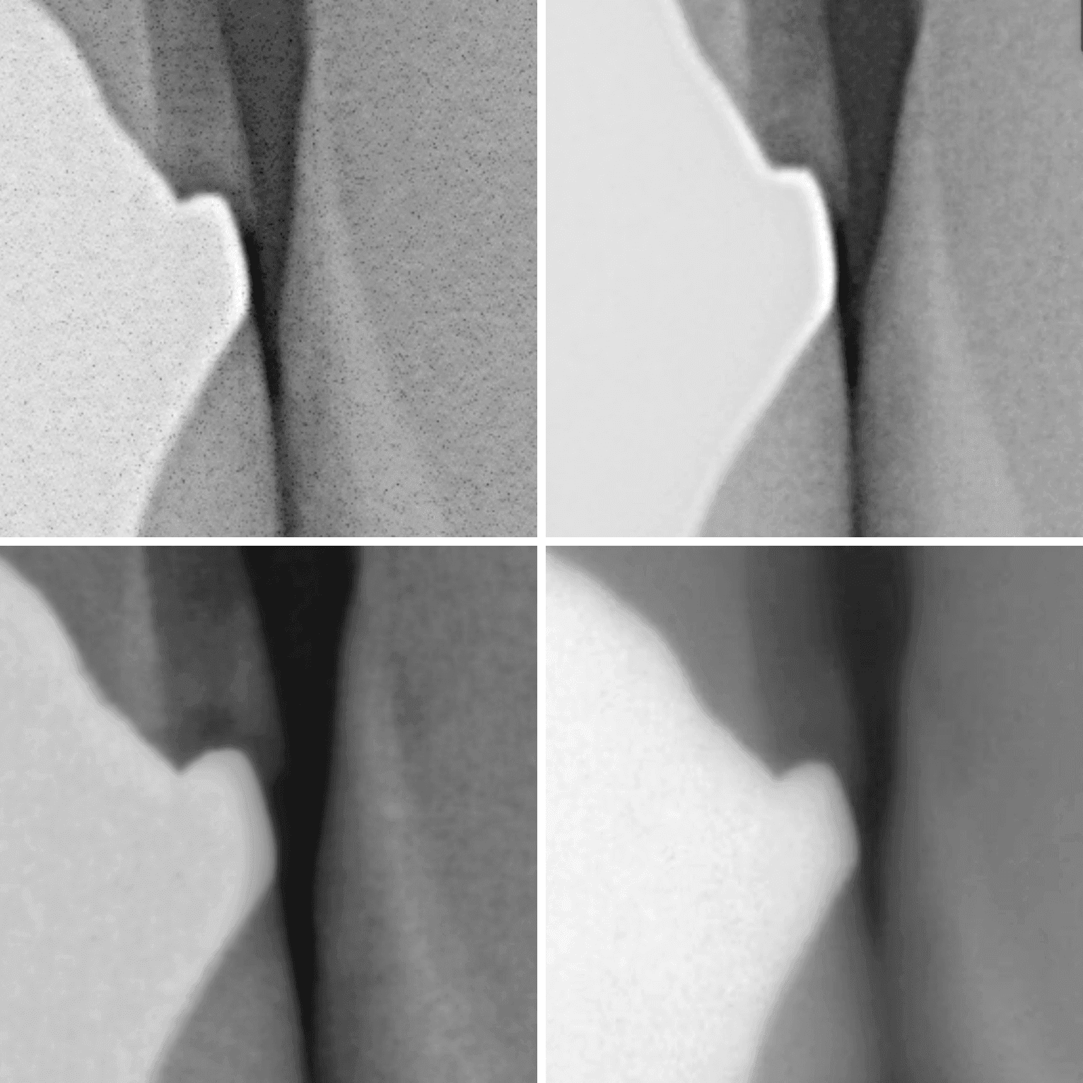 Four-panel close-up of the same tooth restoration margin, each captured by a different scintillator sensor: the panels show visibly different grain, edge sharpness, and contrast from each manufacturer's sharpening filter.