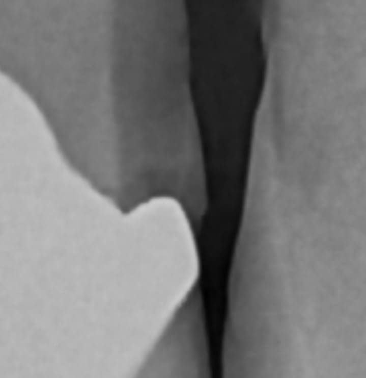 Extreme close-up of a radiograph's interproximal margin, showing continuous gray-scale tonal gradients rather than hard, geometric filter edges.
