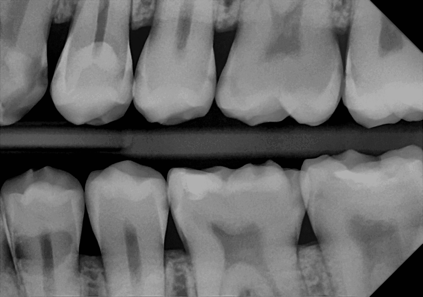 DC-Air™ bitewing radiograph showing upper and lower premolars and molars in sharp detail, including visible root and pulp-chamber outlines, with a horizontal radiopaque bar separating the two arches.