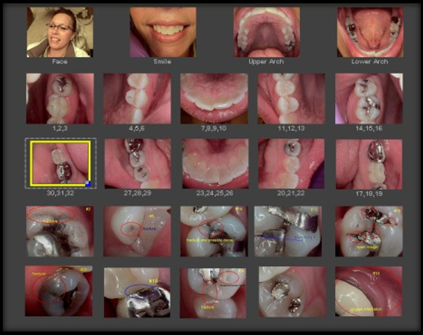 Dental TI's complete intraoral camera exam.