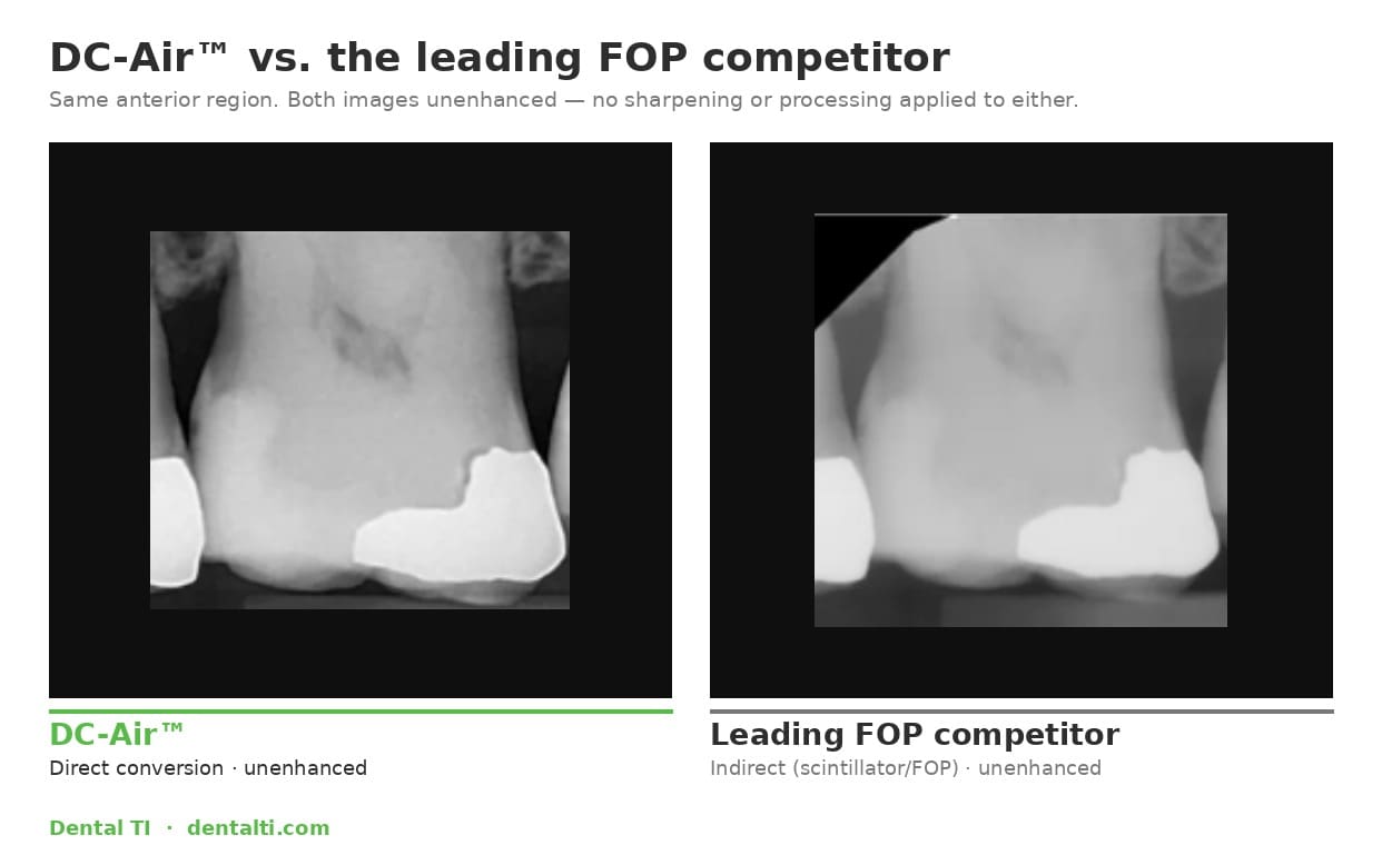 Dental TI comparison of an anterior region, with DC-Air on the left and a conventional scintillator sensor on the right