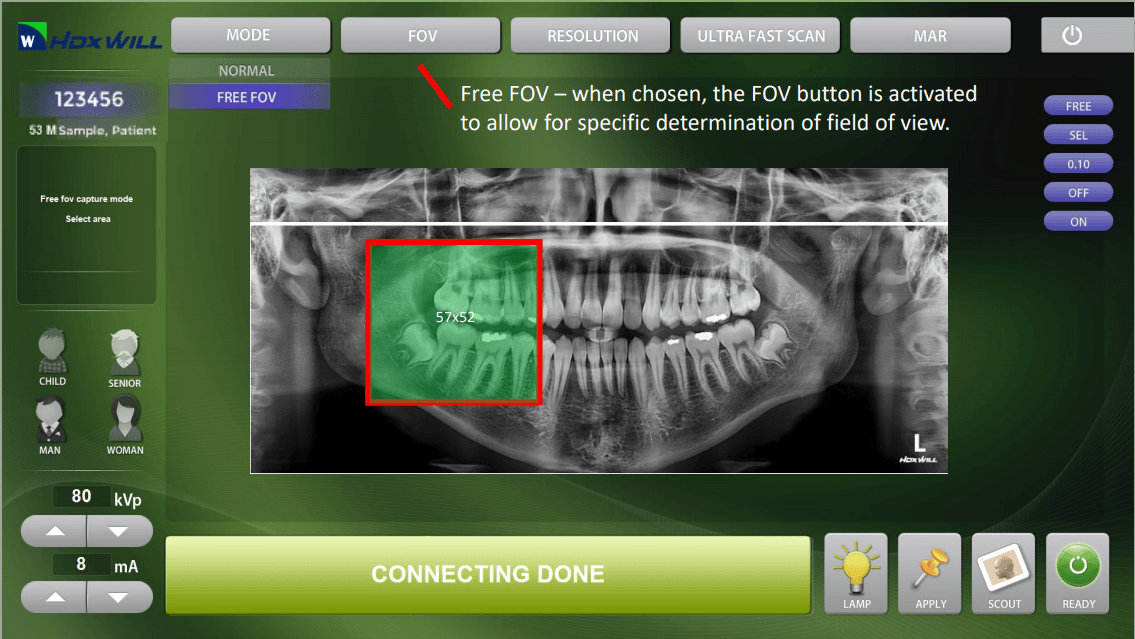 WillMaster acquisition software screen with Free FOV mode selected, showing a green targeting box drawn over a region of interest on a panoramic radiograph