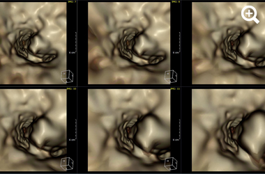 Six-panel grid of virtual endoscopy fly-through renderings showing sequential views through a curved anatomical canal