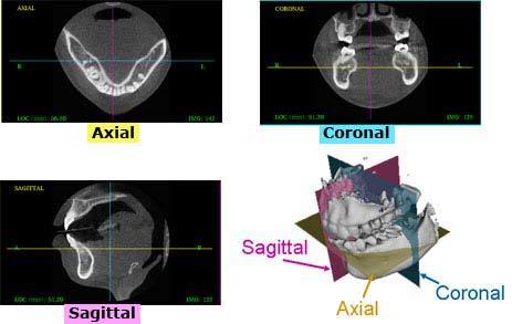 4 Views CBCT Scan