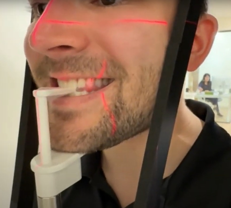 Laser beam alignment for panoramic imaging. 