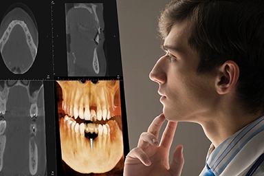 A clinician in profile studying CBCT panoramic and cross-sectional scan images displayed on a monitor