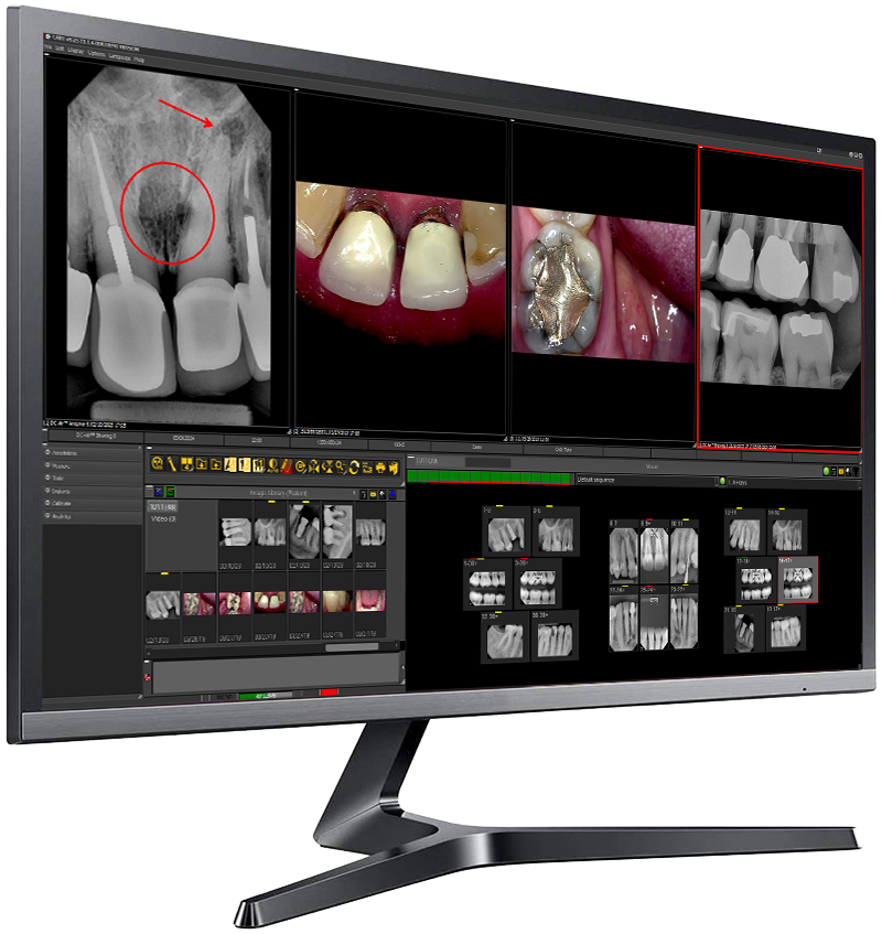 CADI Advanced Dental Imaging software interface